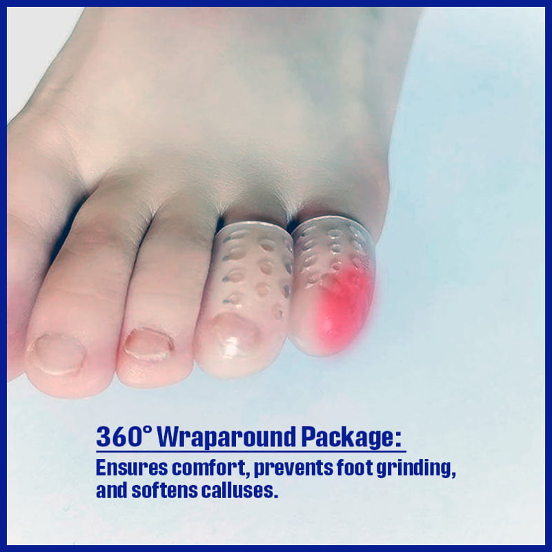 Painful sore toe close-up